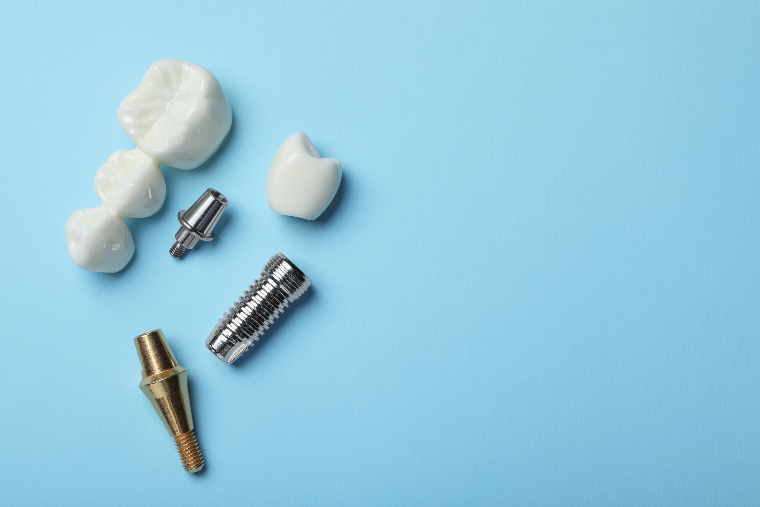 Dental implant and bridge components side by side on a light blue background